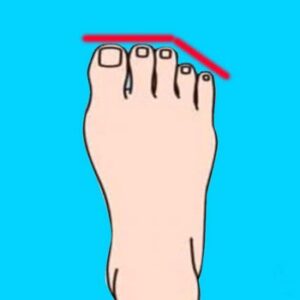 Romalı ayak parmakları